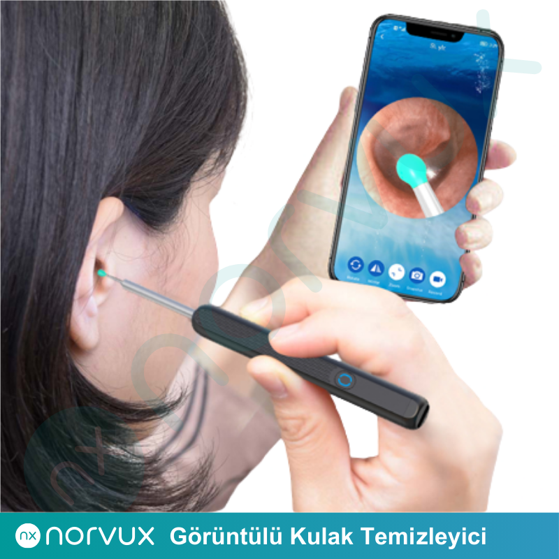 Norvux NE3 Görüntülü Kulak Temizleyici